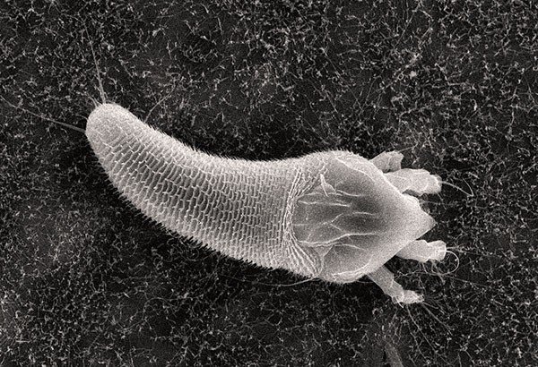Почковый клещ под микроскопом
